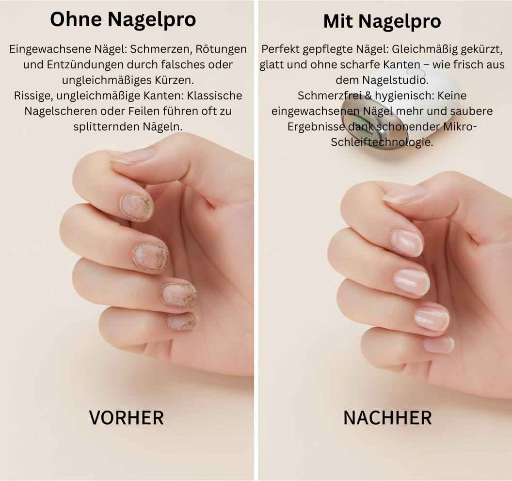 NagelPro